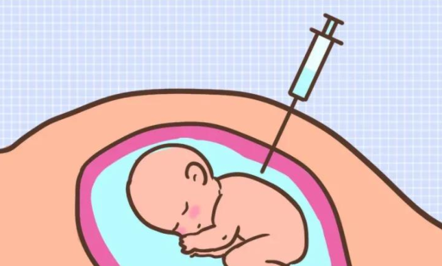 顺产月子注意事项