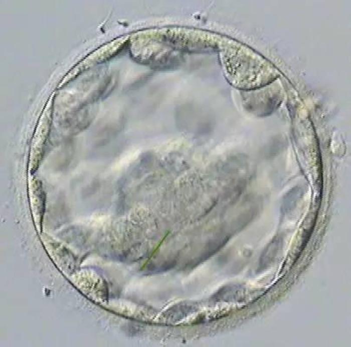 拉萨不孕不育医院