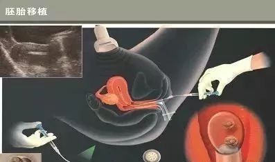 马鞍山助孕杀309584q合作上词