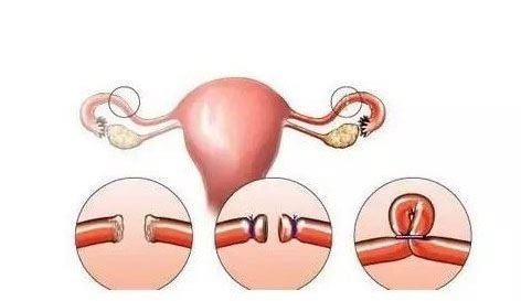 60岁做试管婴儿